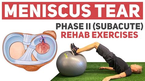 meniscus tear rehab protocol pdf